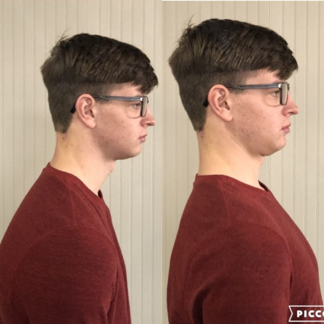 Mediwell ErgoFlex™ Neck Relief Pillow