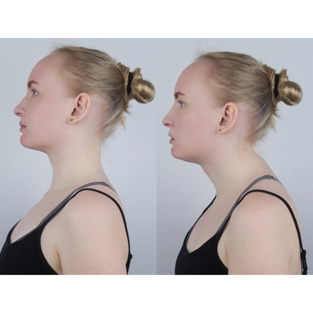 Mediwell ErgoFlex™ Neck Relief Pillow