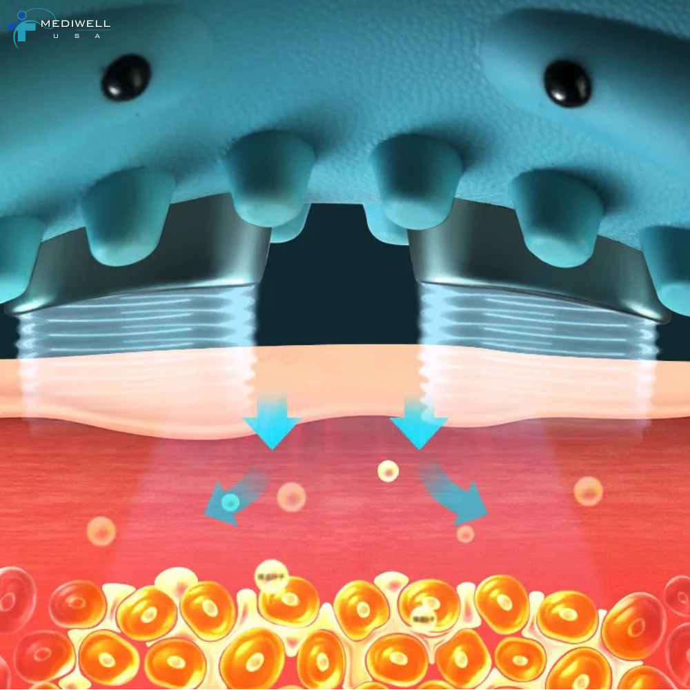 Mediwell NeckRelief Ultra™ – Professional EMS Heating Cervical Pillow